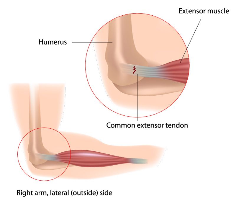 Diagram of the elbow joint