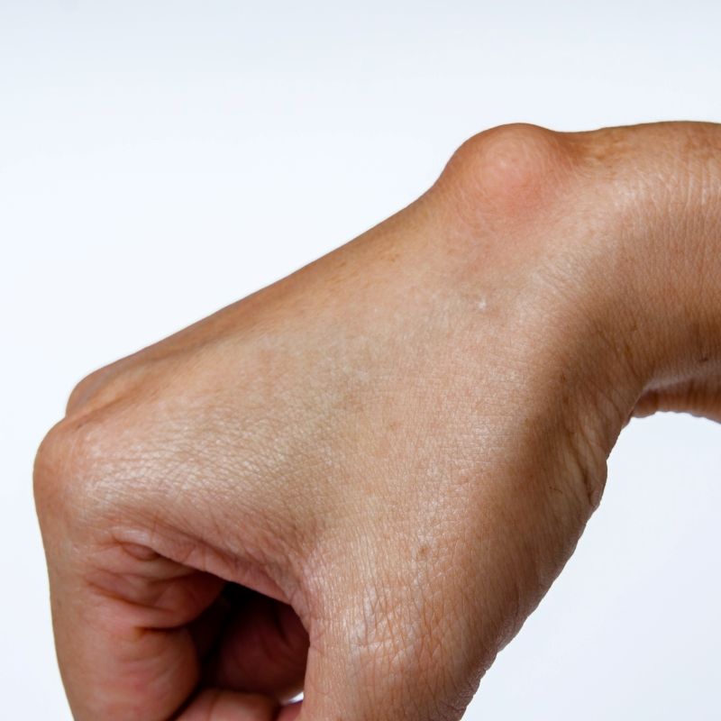 Person with sore wrist